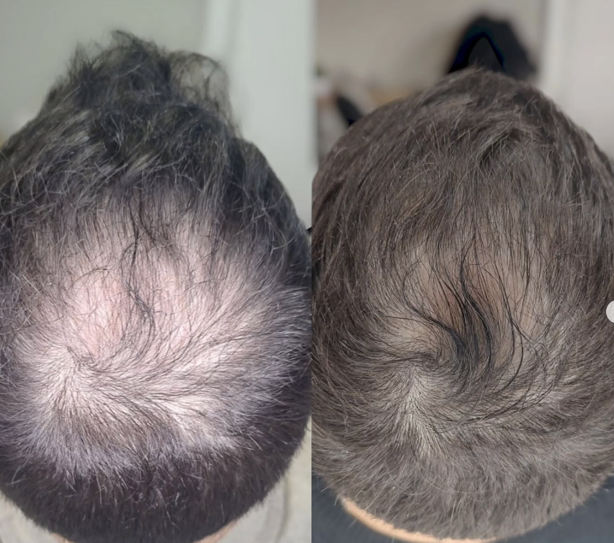 Procell Hair